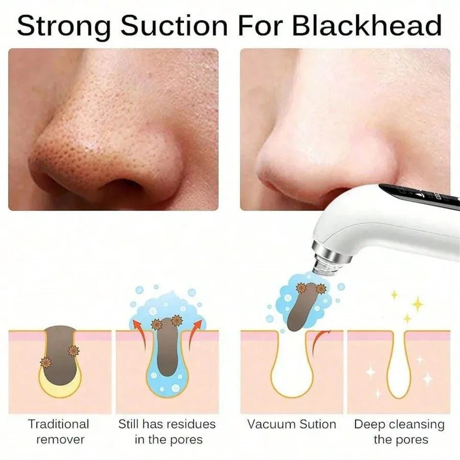 Viorra Anti-blackhead